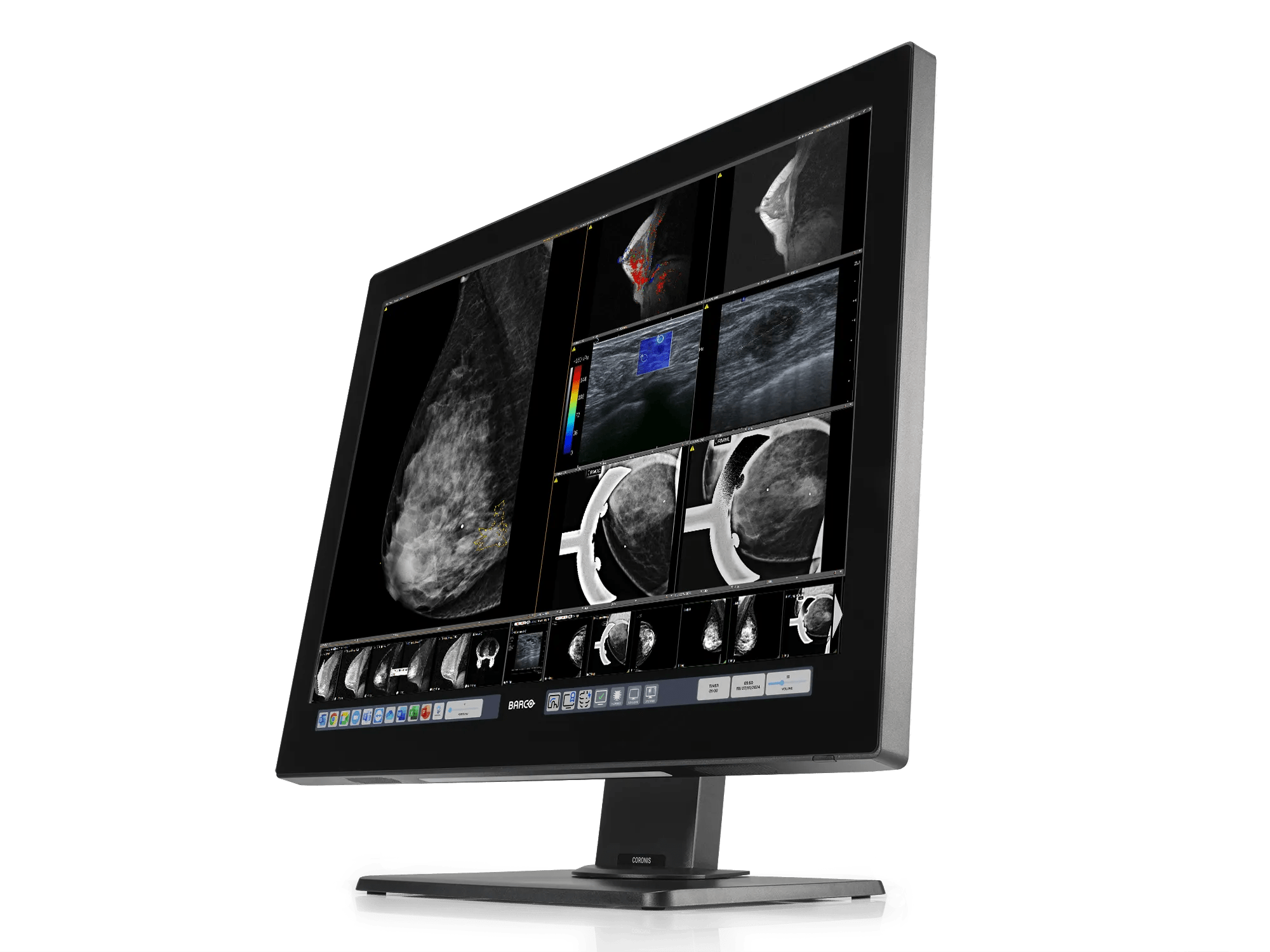 Diagnostic Imaging Sales Associate Barco