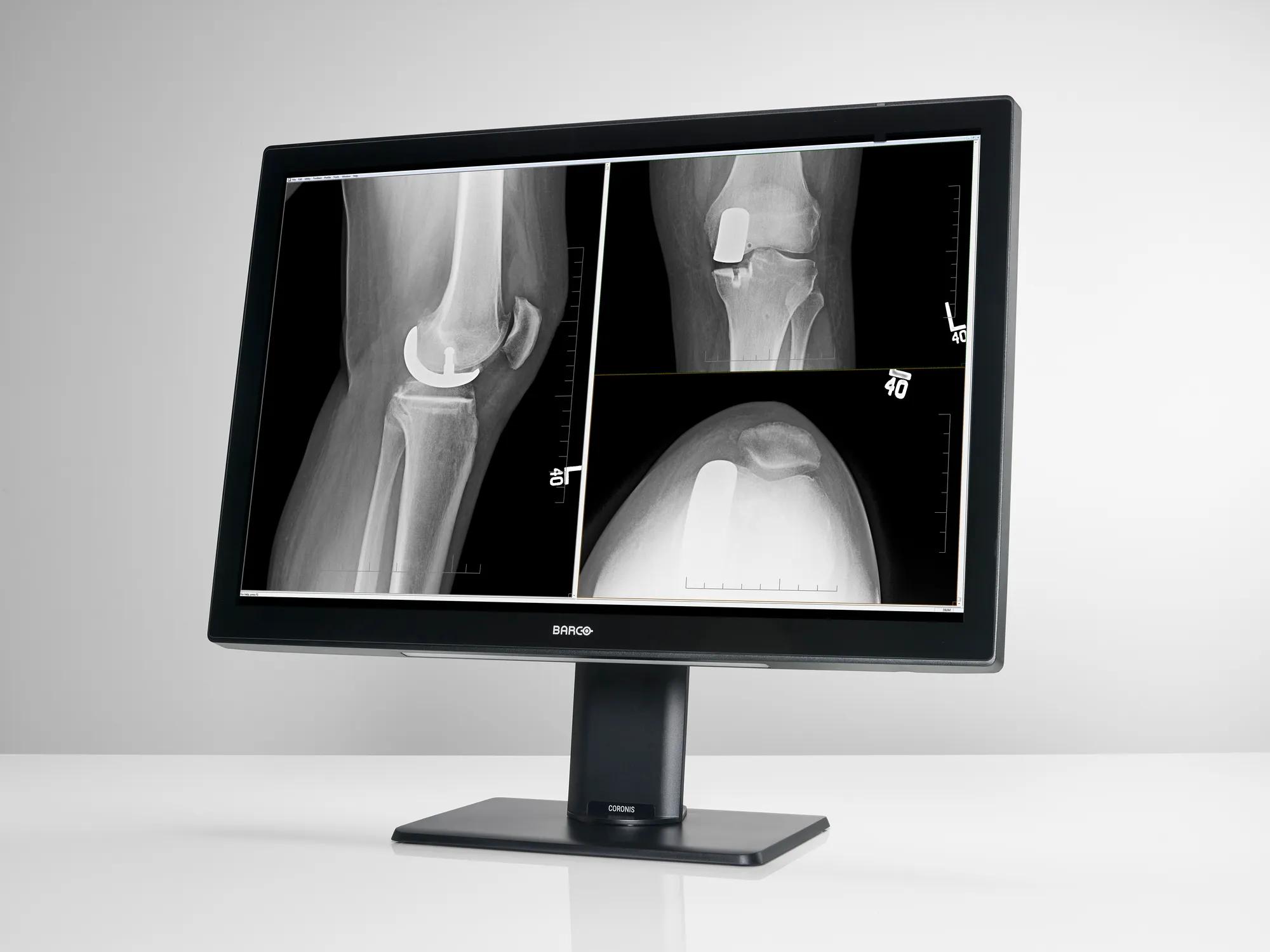 Coronis Fusion 4MP (MDCC-4430) - Radiology displays - Barco