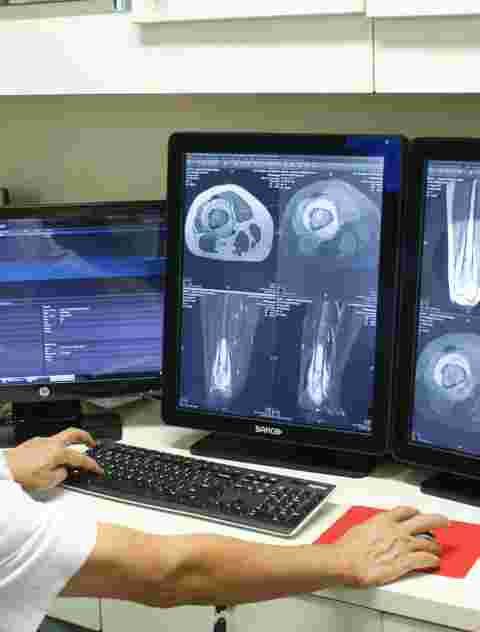 A radiologist at Ramsay Health Care Hospital using Barco Nio medical displays