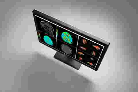 医疗显示器 - Barco