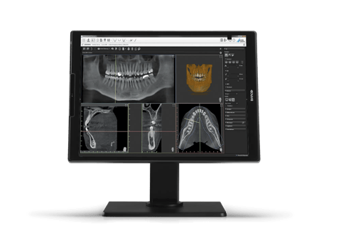 Nio dental 2MP
