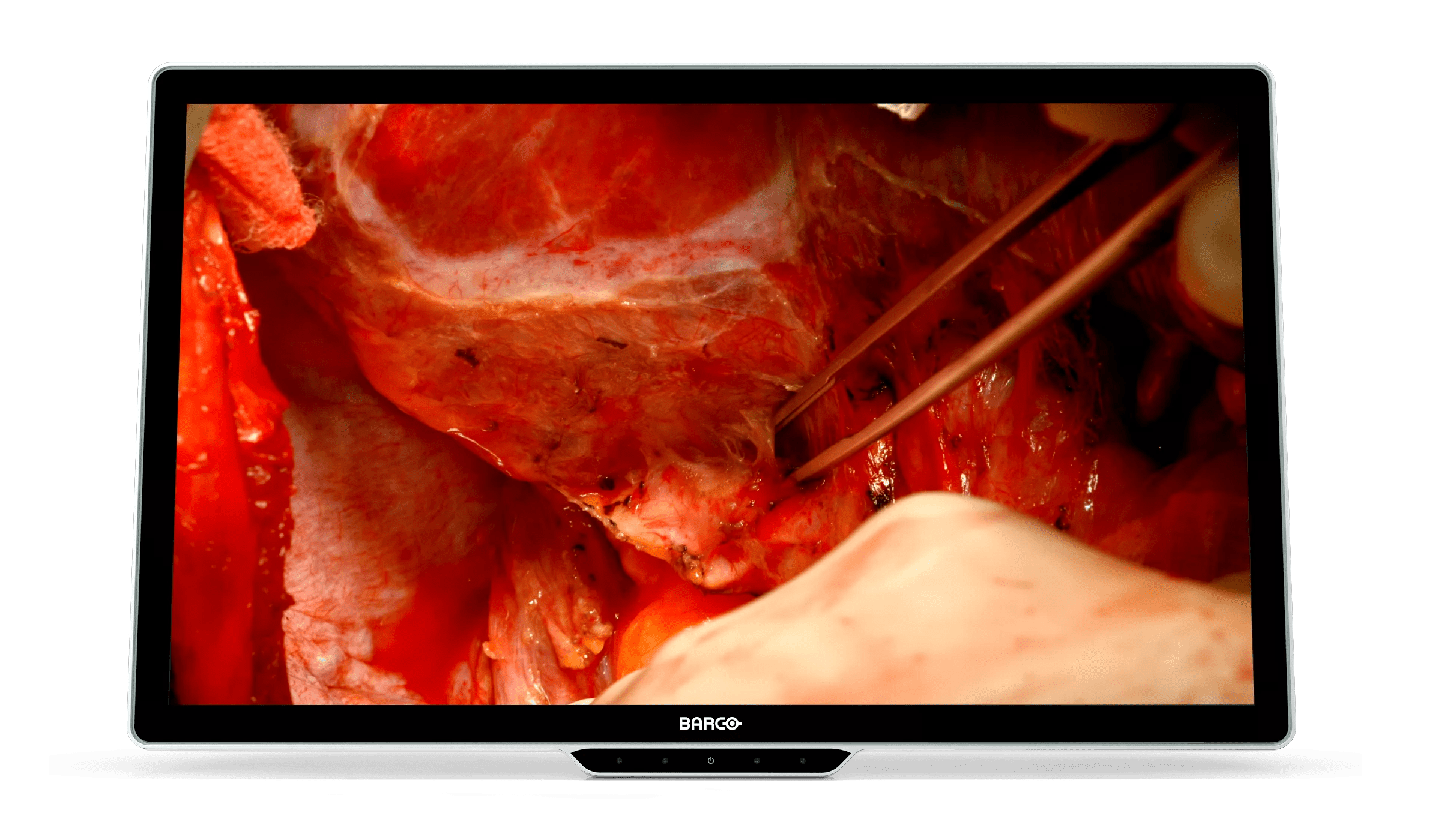 Monitores quirúrgicos 4K de 32