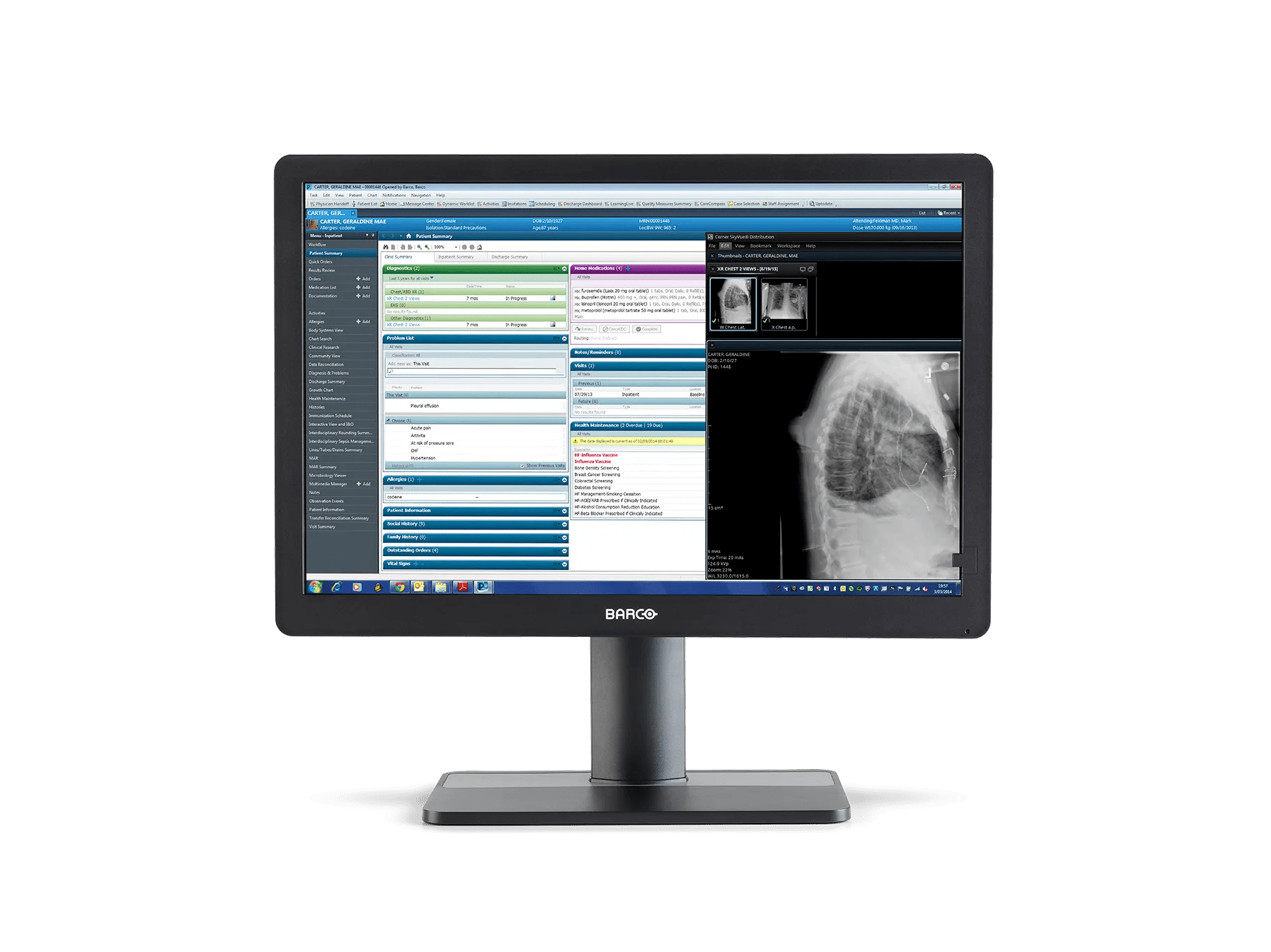 Eonis 24 pouces (MDRC-2324) - Barco