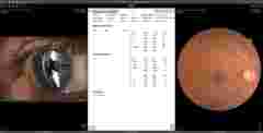 Ophthalmology