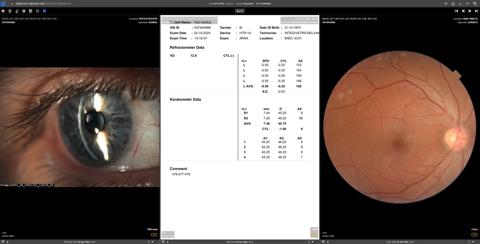 Ophthalmology