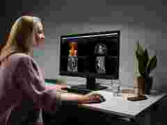 A radiologist looking at diagnostic images on a Barco Nio Color 8MP (MDNC-8132) radiology display