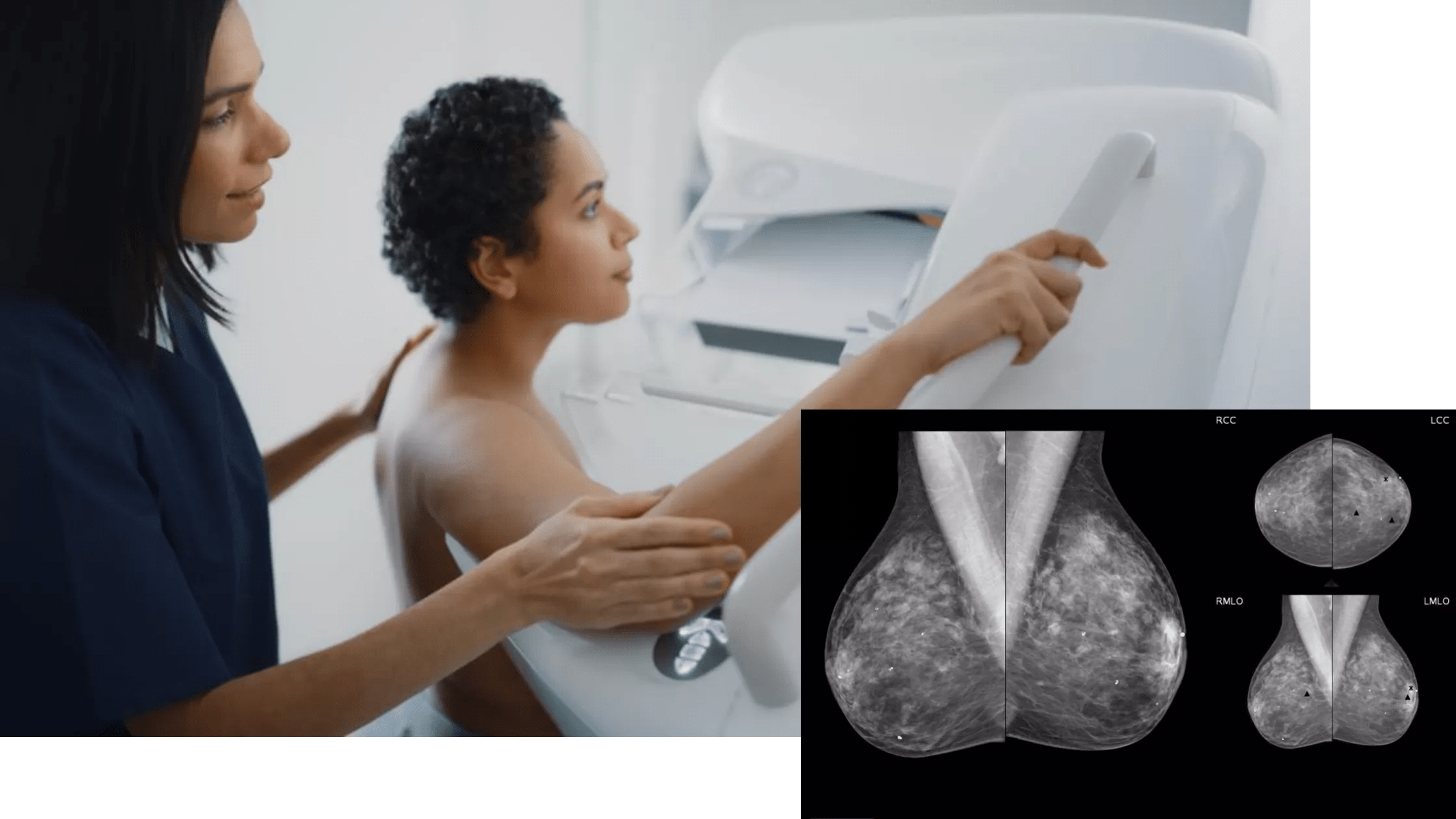 Picture of a woman being guided by a nurse as a mammogram is taken. Next to the picture, and example of a mammogram.
