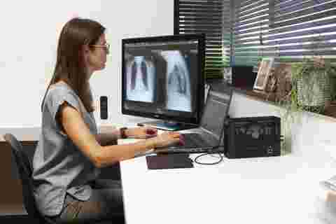 A radiologist working comfortably at home with Barco radiology displays