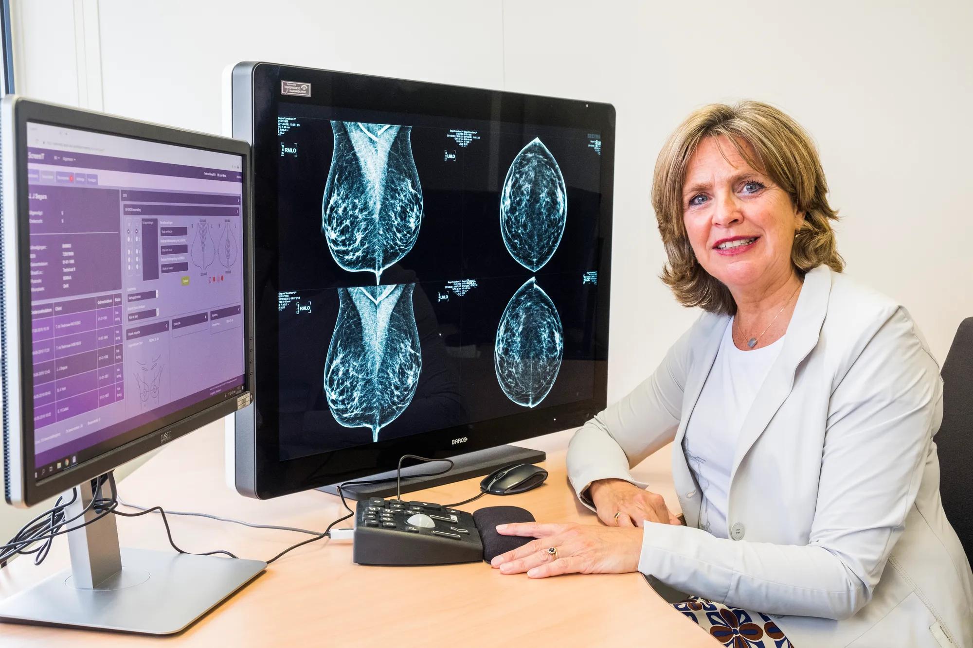 Dutch breast cancer research program Barco