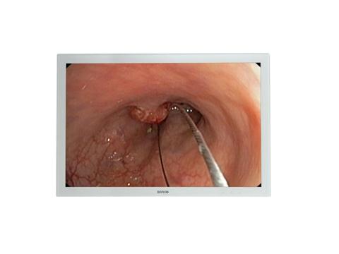 Barco MDSC-2124 medical display monitor.