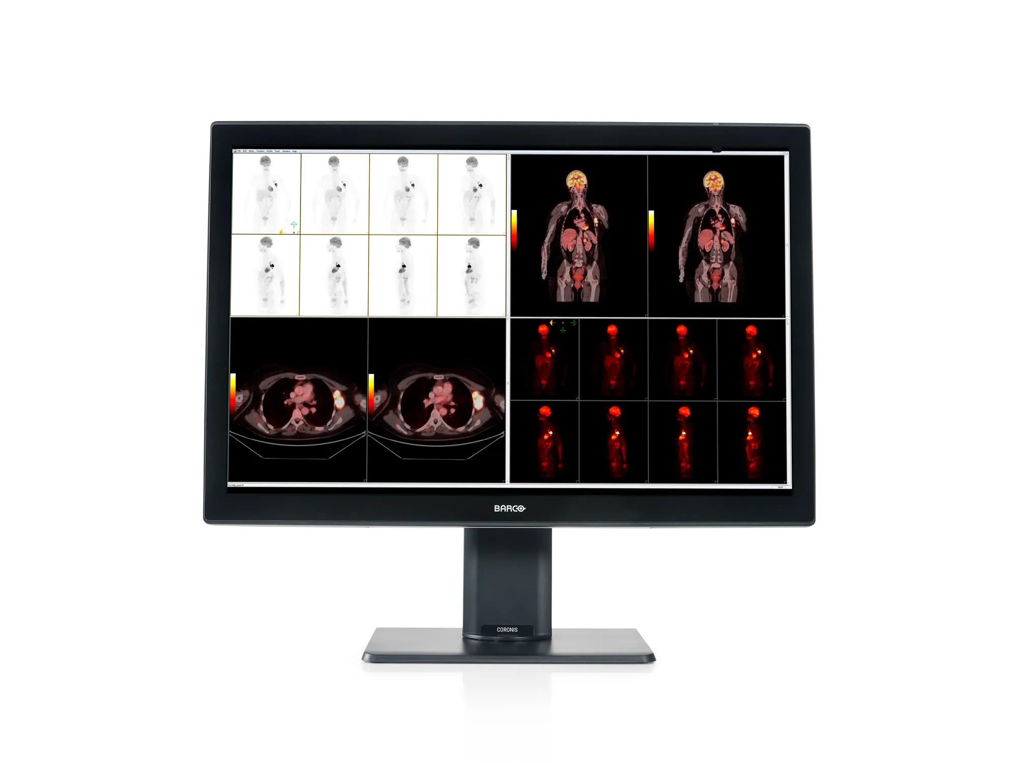 Coronis Fusion 6MP (MDCC-6530 Option CN) - Radiology displays - Barco