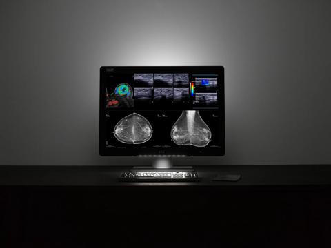 Uniti display with SoftGlow and keyboard light