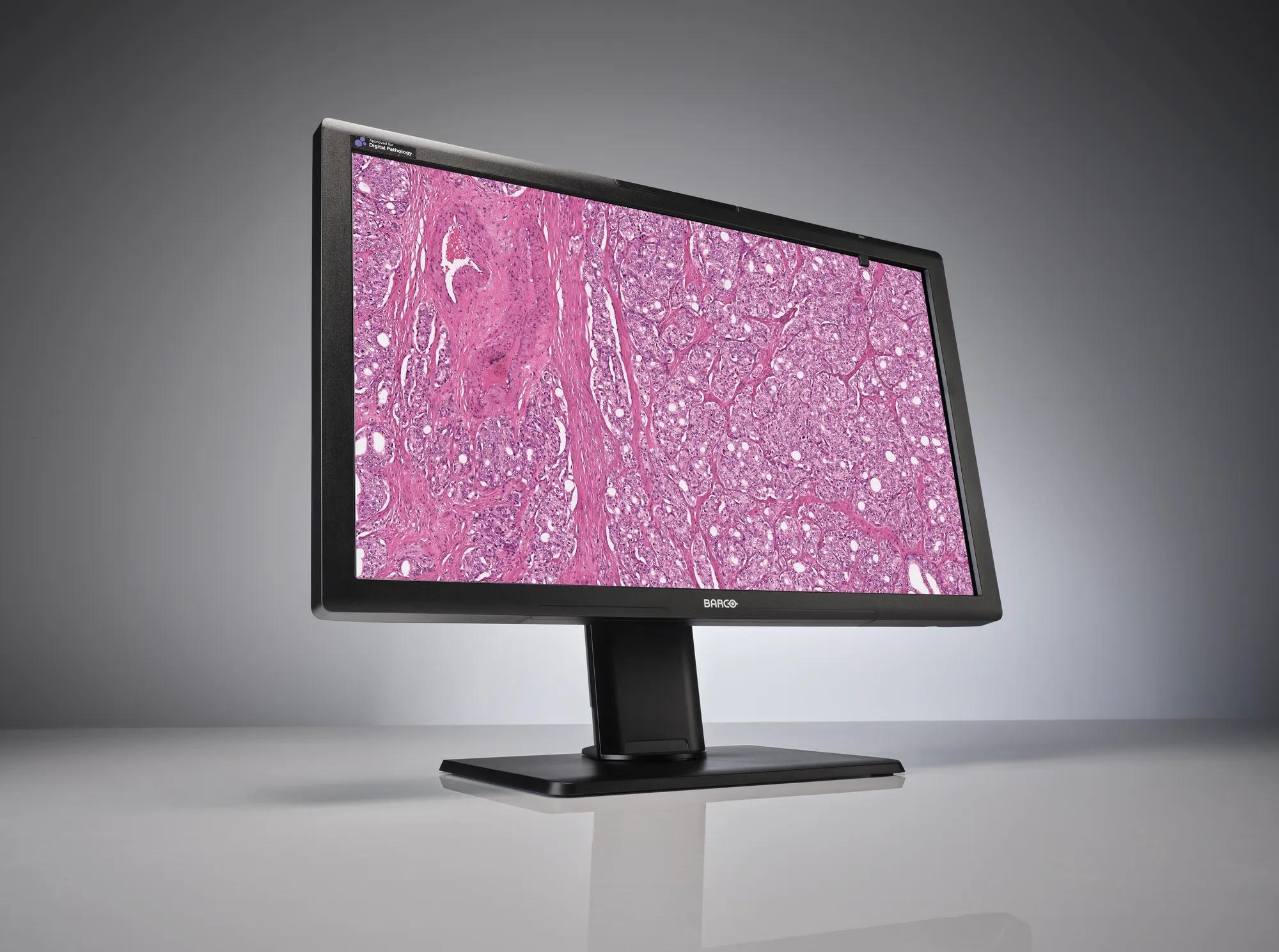 Serrado Vandalir En la cabeza de Digital pathology displays | Barco