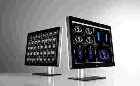 Radiologie-Displays - Barco