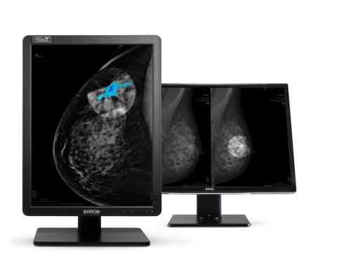 collage used at RSNA 2023 to illustrate DL Precise and SpotView