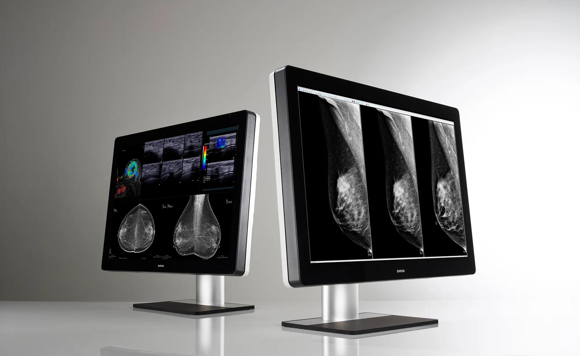 Medical Display System Support - Barco
