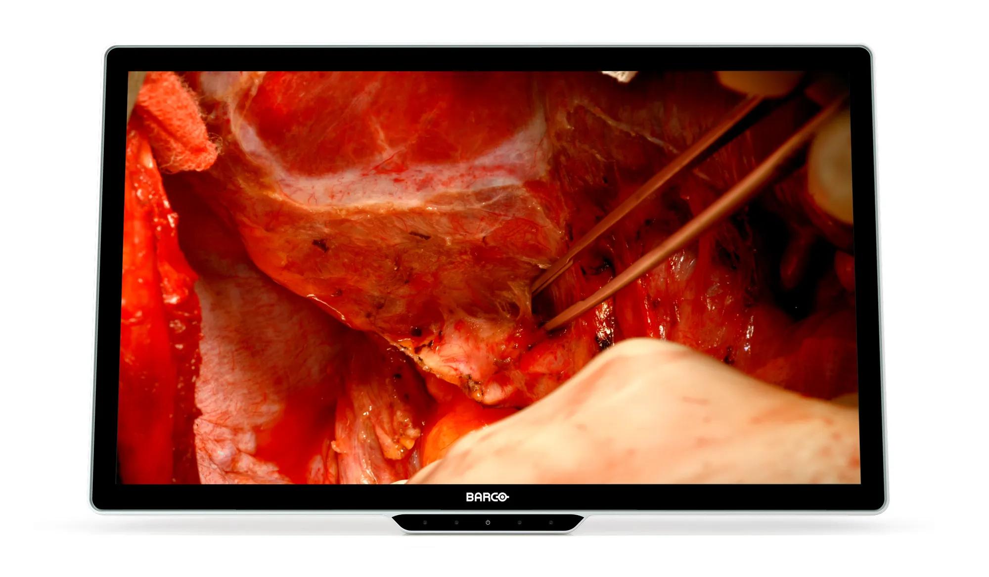 4K 32 surgical display