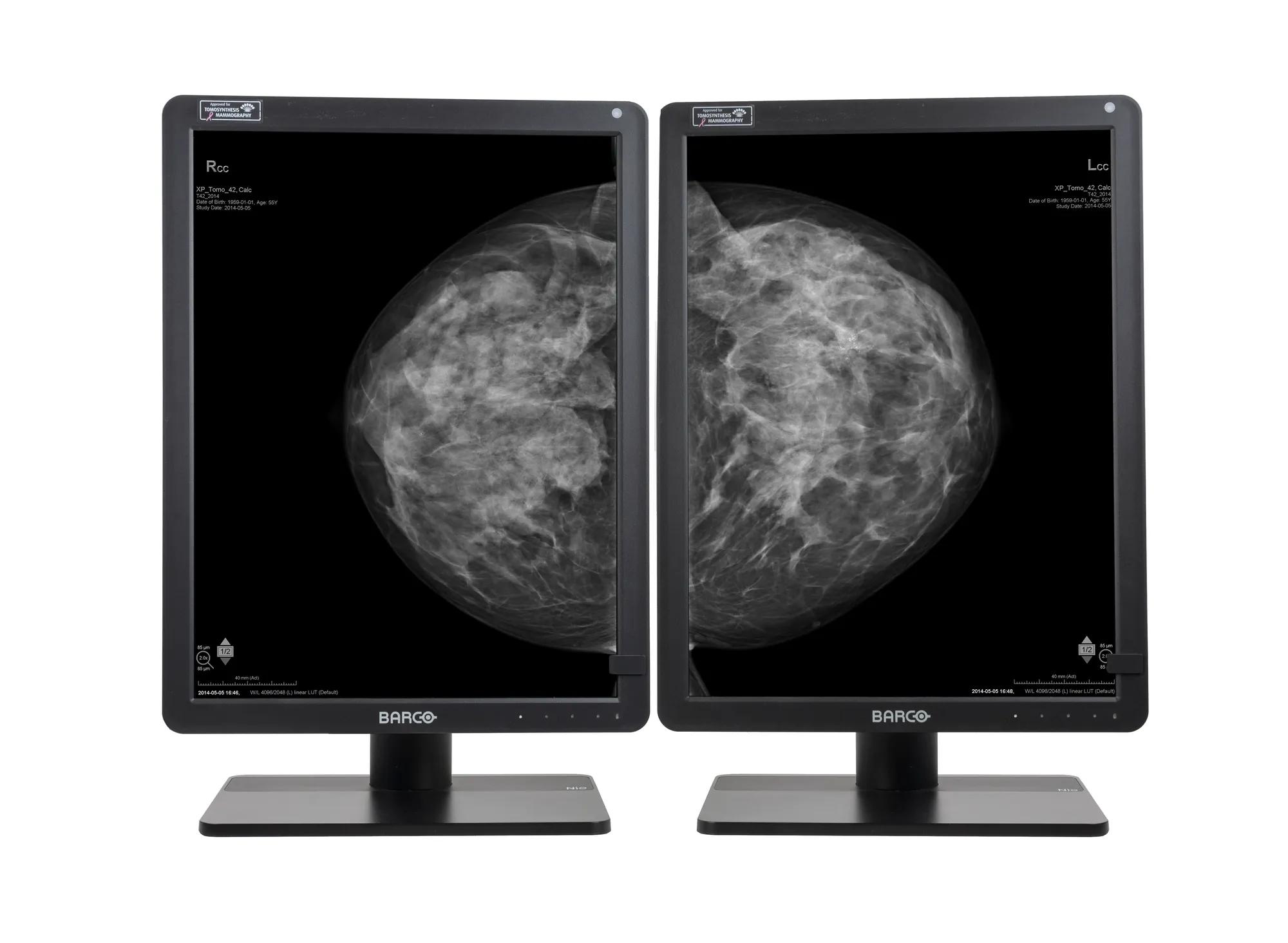 Calibrated Digital Mammography Scale