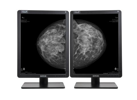 dual head Nio 5.8MP Grayscale with mammo content