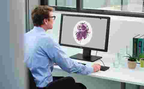 A pathologist looking at Barco MDPC-8121 medical display for digtial pathology