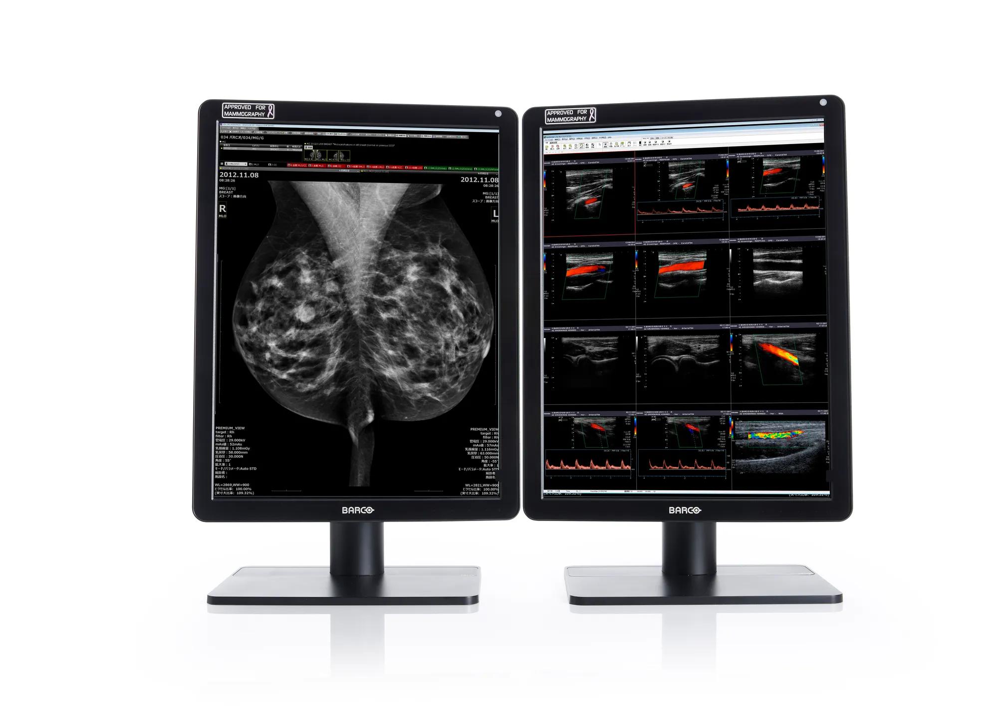 Nio Color 5MP (MDNC-6121) - Breast imaging displays - Barco