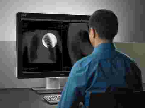 Male radiologist working on Unitit display with SpotView tool on chest x-ray image