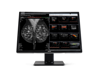 Nio Fusion 12MP transparent product shot