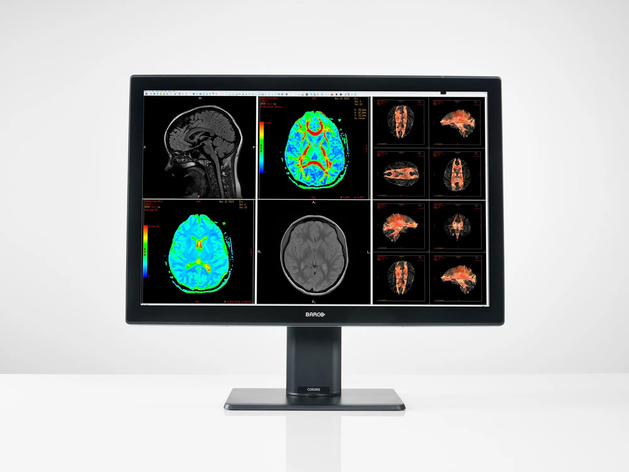 Coronis Fusion 6MP (MDCC-6530 Option CN) - Radiology displays - Barco