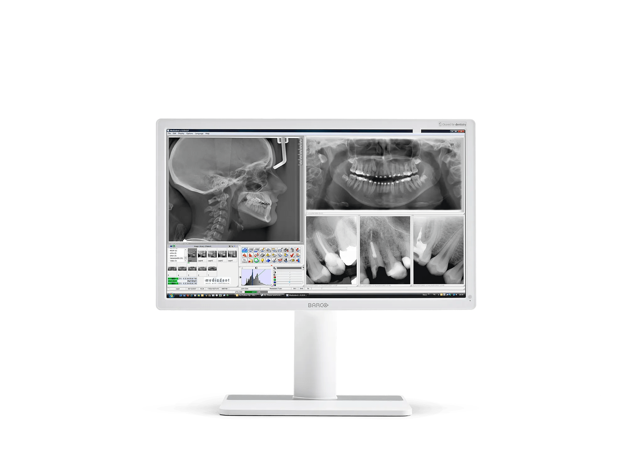 Nio Color 2MP (MDNC-2123 Option DE) Dental - Стоматологические дисплеи -  Barco