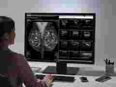 A doctor working comfortably with Barco breast imaging displays
