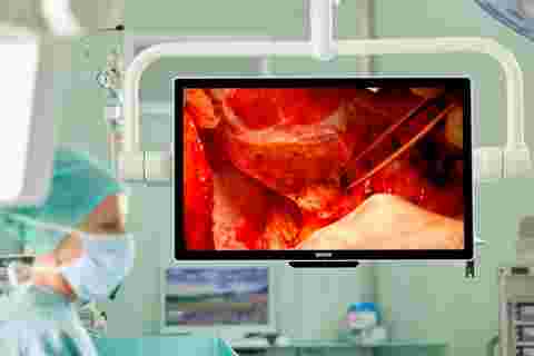 MDSC‑8532, Barco 4K UHD surgical display