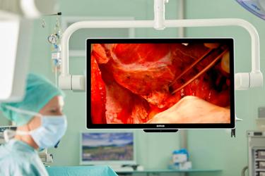 MDSC‑8532, Barco 4K UHD surgical display