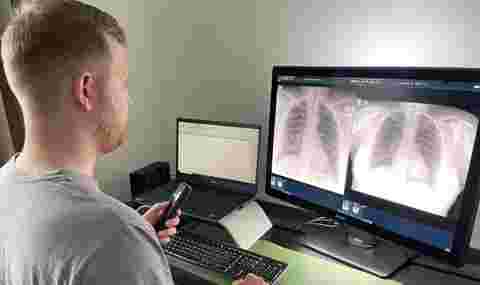 A radiologist looking at high-res images on a Barco medical display