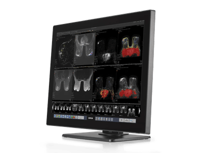 Radiology monitor - Barco